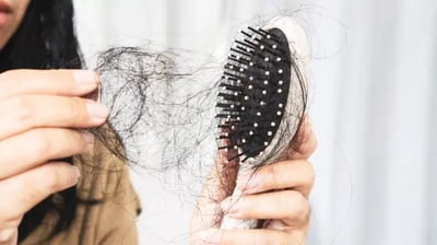 ¿Mounjaro causa caída de cabello?